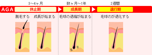 ヘアサイクル